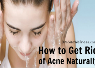 How to Get Rid of Acne Naturally