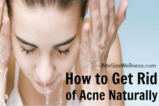 How to Get Rid of Acne Naturally